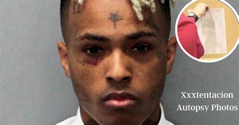 xxxtentacion autopsy photos leaked|Jahseh Onfroy (XXXTentacion) Autopsy Report